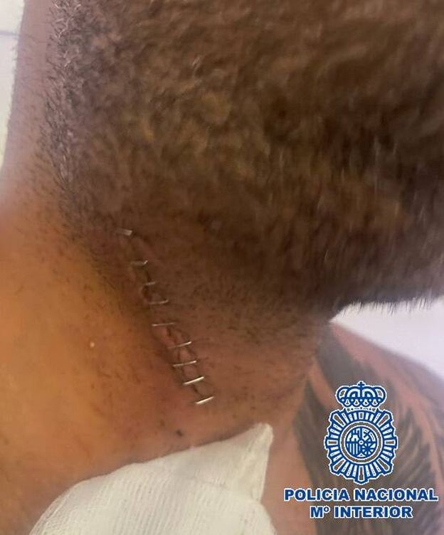 Foto: Herida que causó a su última víctima en el cuello. (Policía Nacional)