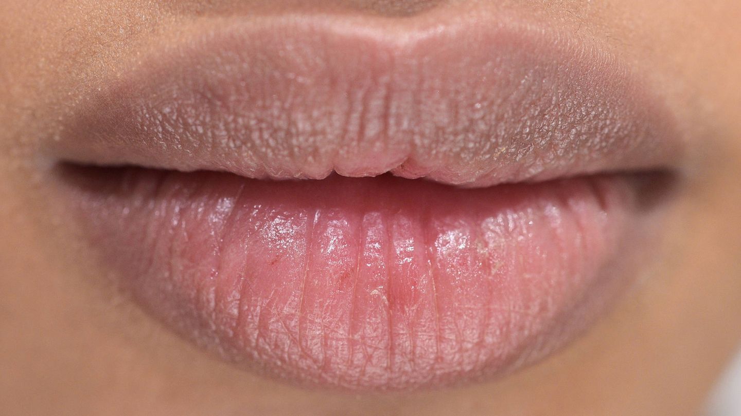 El labios superior suele ser el primero en perder volumen. (Getty)
