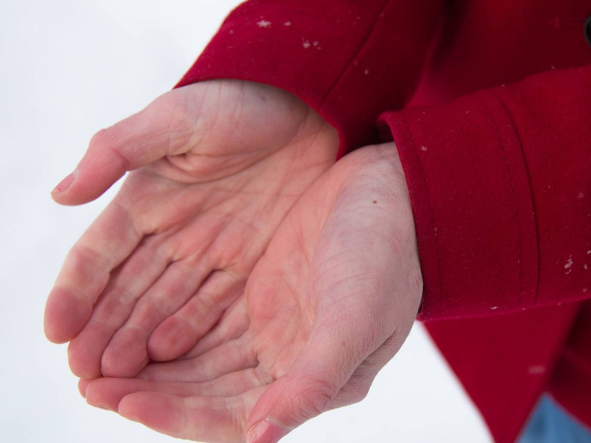 Equipar conjunción parásito El síndrome de Raynaud: la enfermedad de las manos frías
