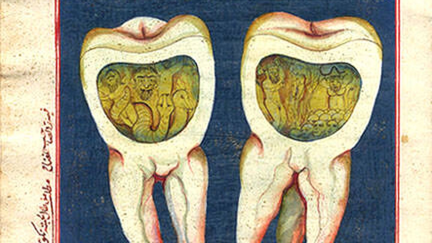 Ilustración en pergamino del llamado 'gusano de los dientes'. Fuente: Wikipedia