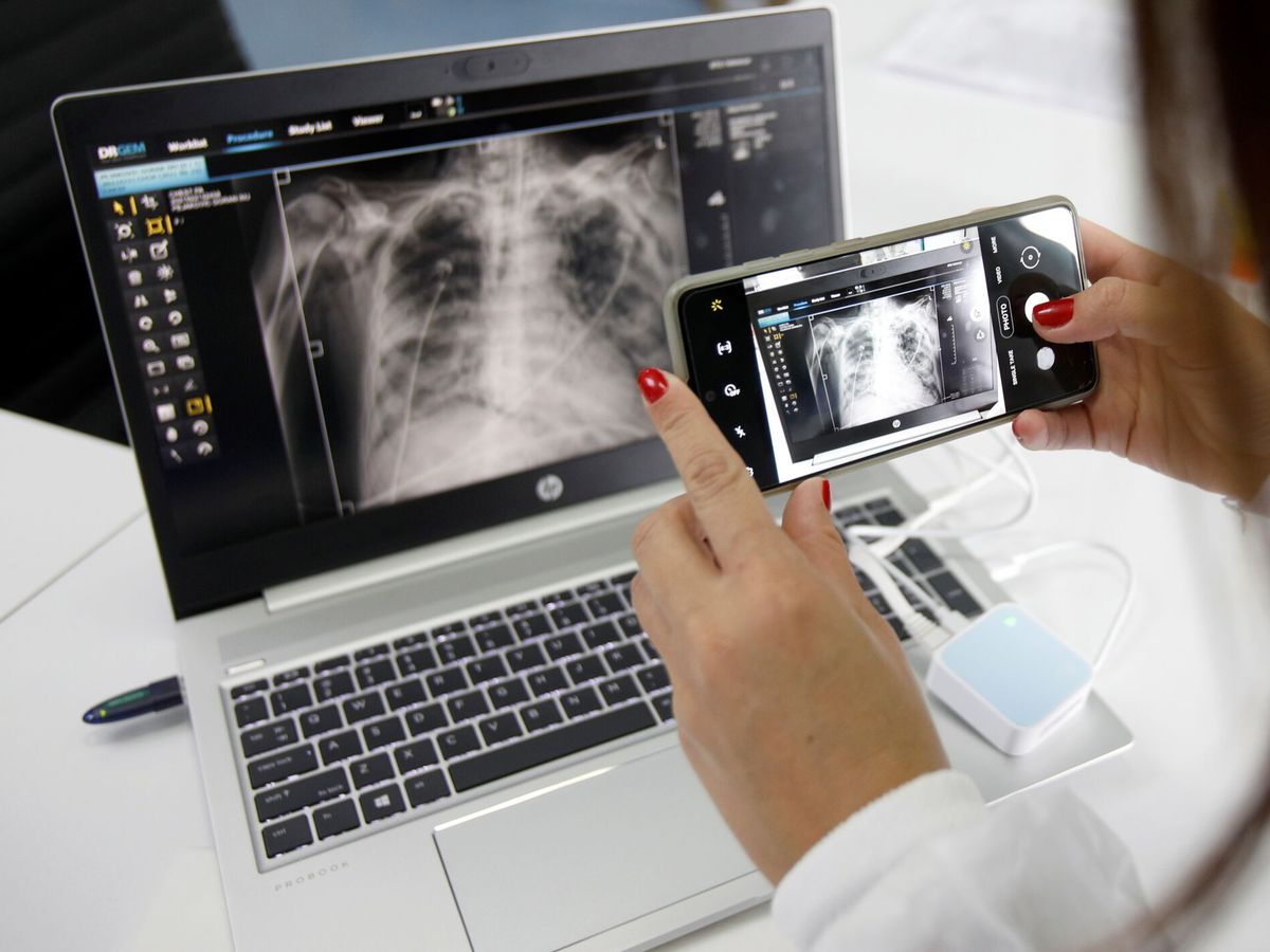 Foto: Radiografía de tórax de un enfermo de covid-19. (Reuters/Stevo Vasiljevic)