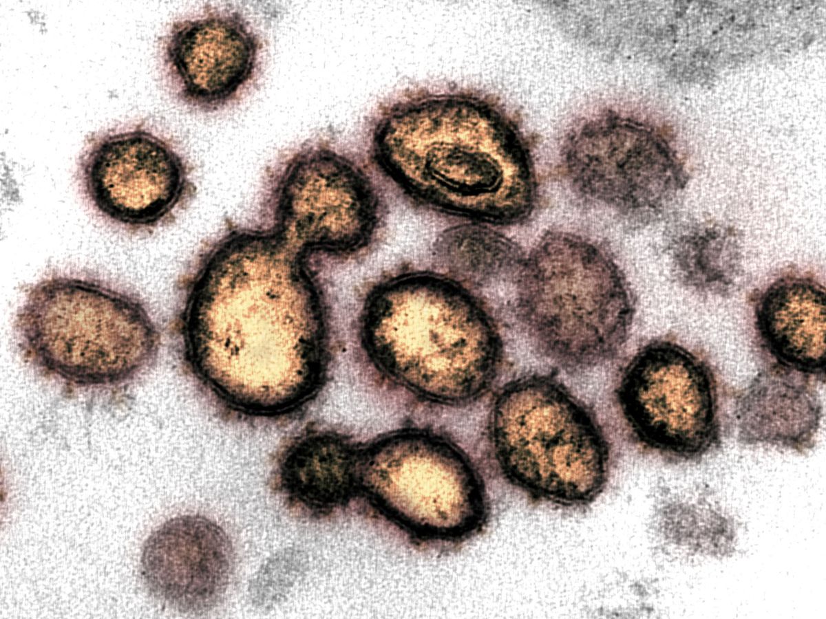 Foto: Imagen del coronavirus vista con microscopio. (Reuters)