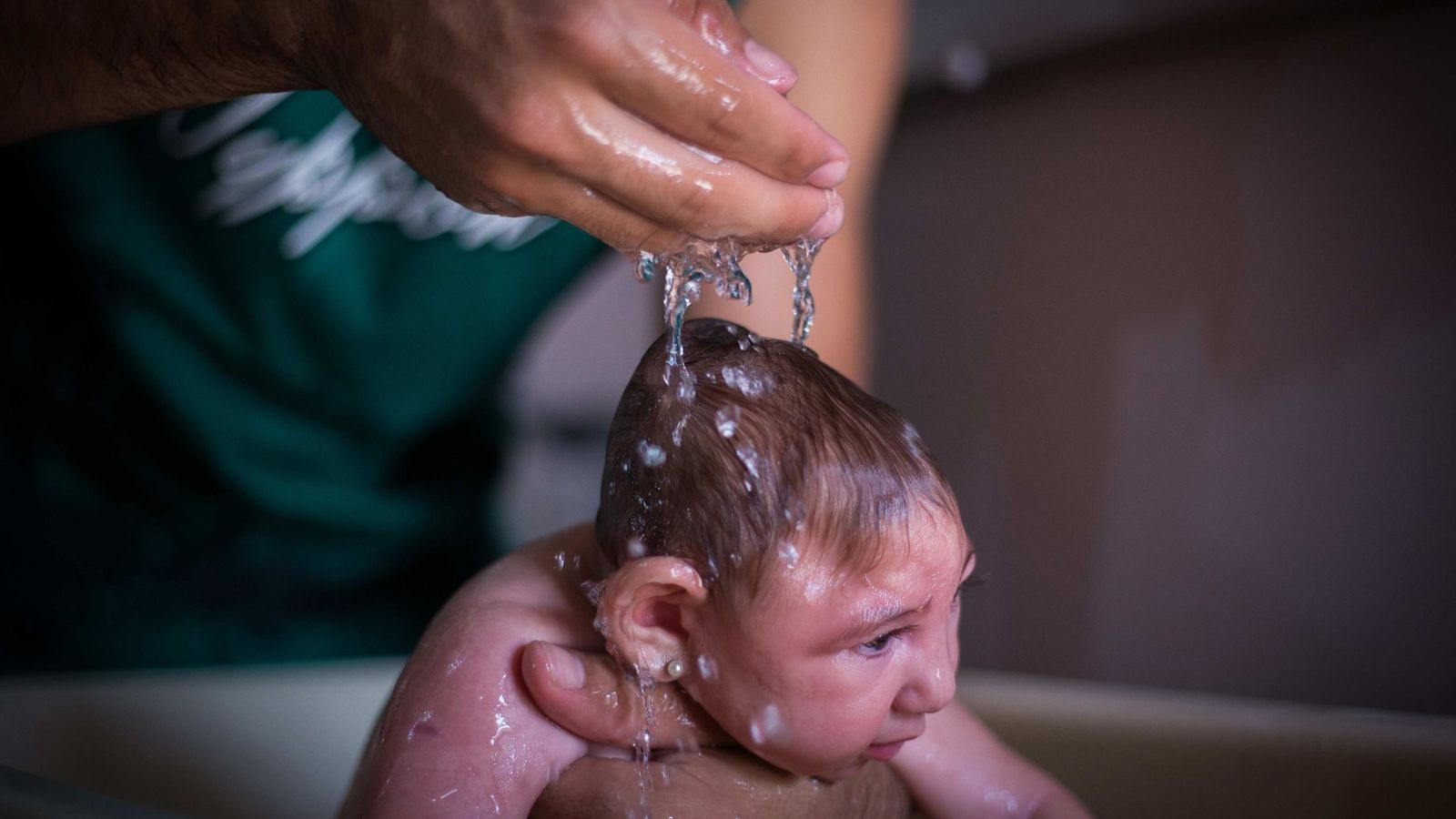 Foto: Imagen de un bebé con microcefalia nacido en Brasil. (EFE)