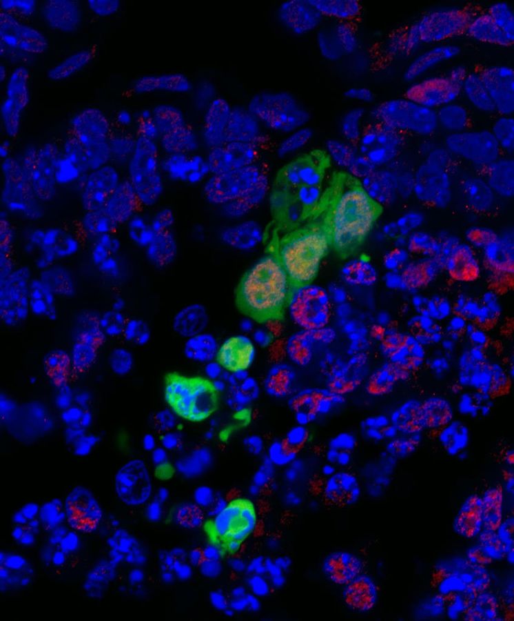 Foto: Imagen de un embrión de ratón en cuyo interior se ven células pluripotentes humanas (Cortesía del Instituto Salk)