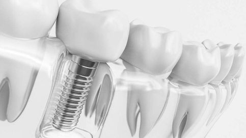 La vitamina D juega el partido de los implantes dentales: así es su influencia
