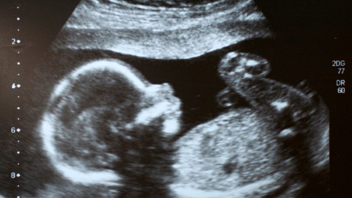 ¿Los bebés lloran dentro del útero? Responden los expertos