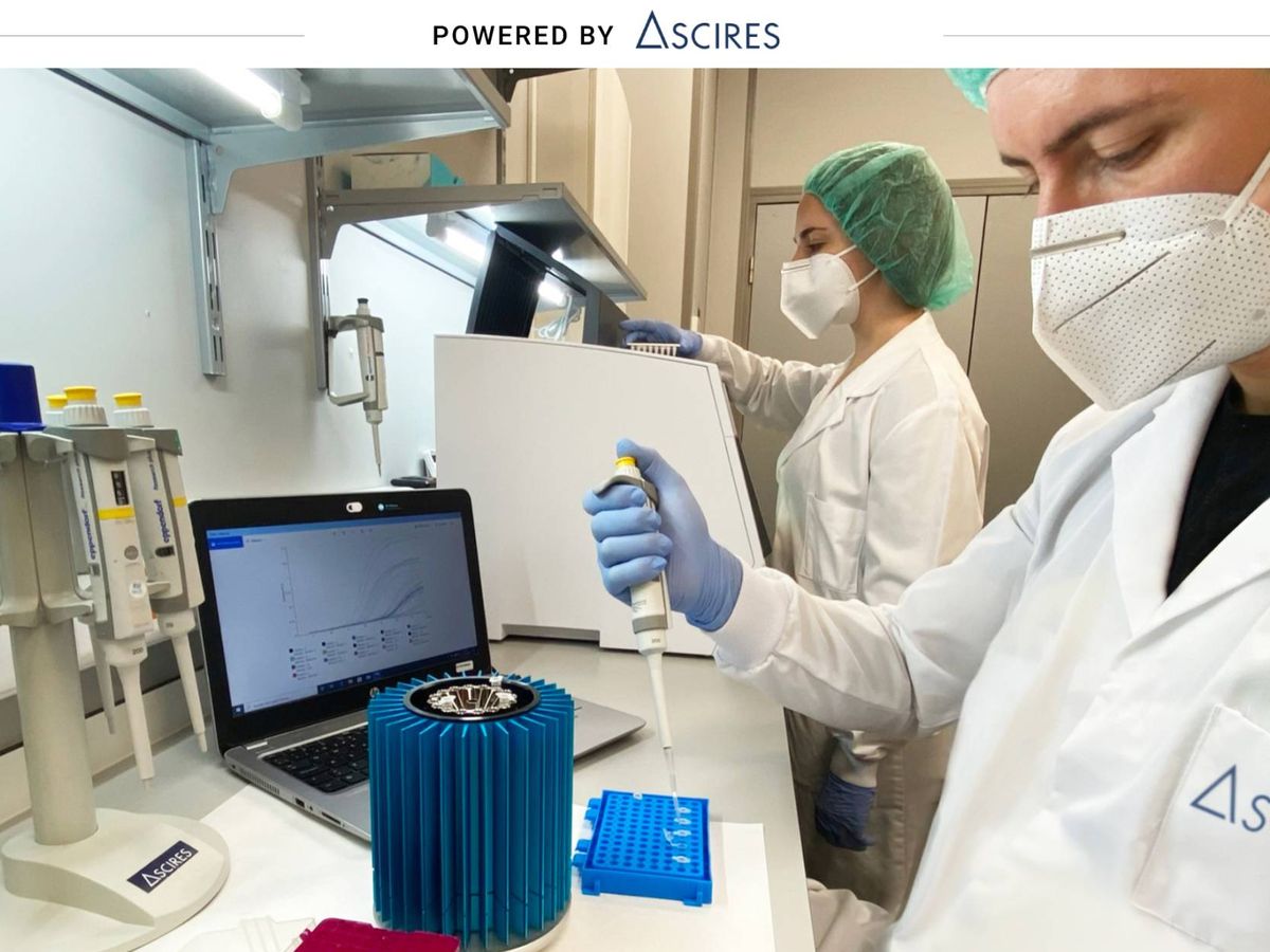Foto: El objetivo es reducir costes y plazos en la detección del covid-19, manteniendo la fiabilidad de la PCR.