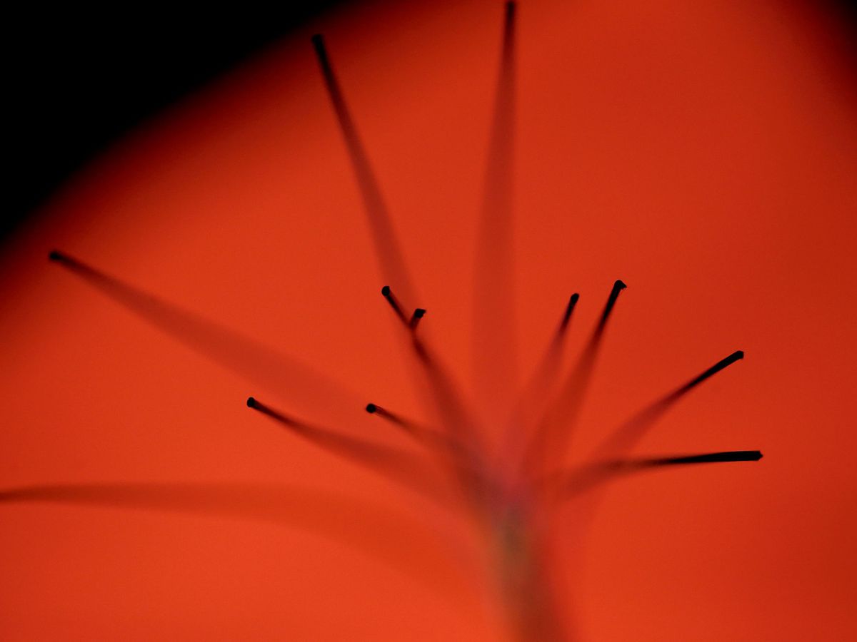Foto: Las endoscopias de fibra óptica son 10 veces más finas que las actuales. (Reuters)