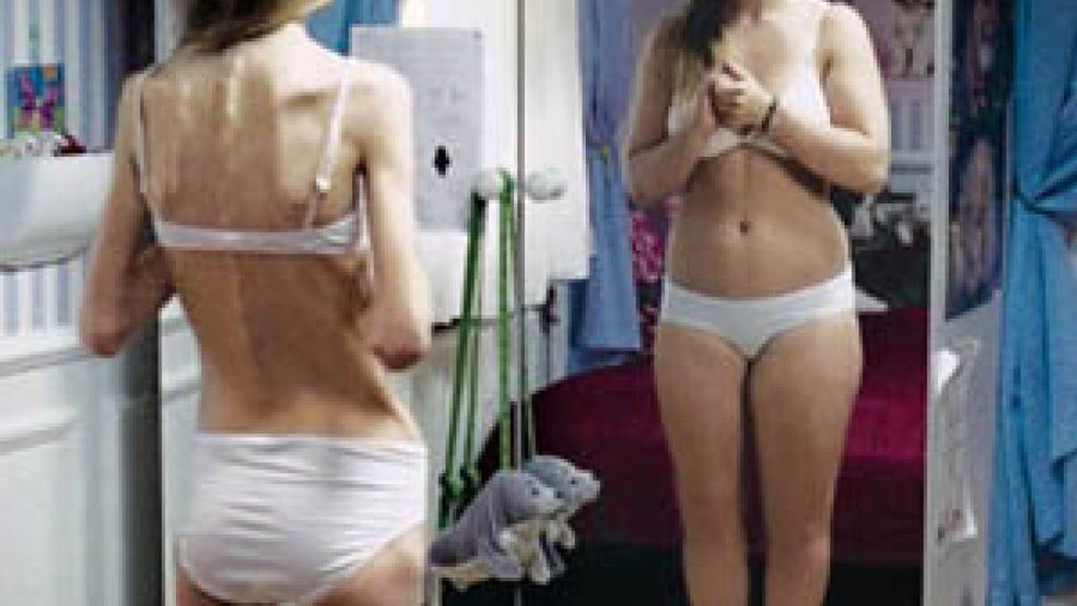 Guía para reconocer los signos de la bulimia y anorexia