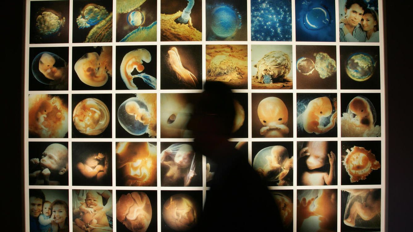 Foto: Un doctor pasa por delante de un cartel con imágenes del desarrollo de un feto humano en una clínica de fertilidad del doctor Severino Antinori. (Reuters)