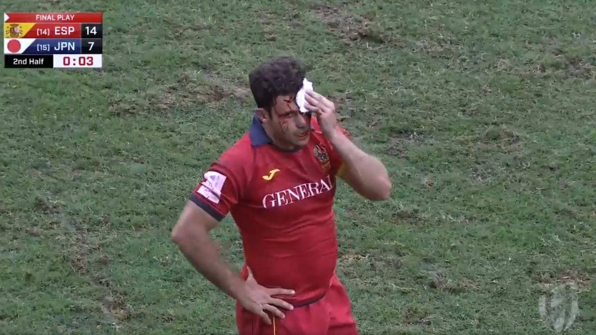 "Veía todo teñido de sangre". Los entresijos de la jugada más viral del rugby español