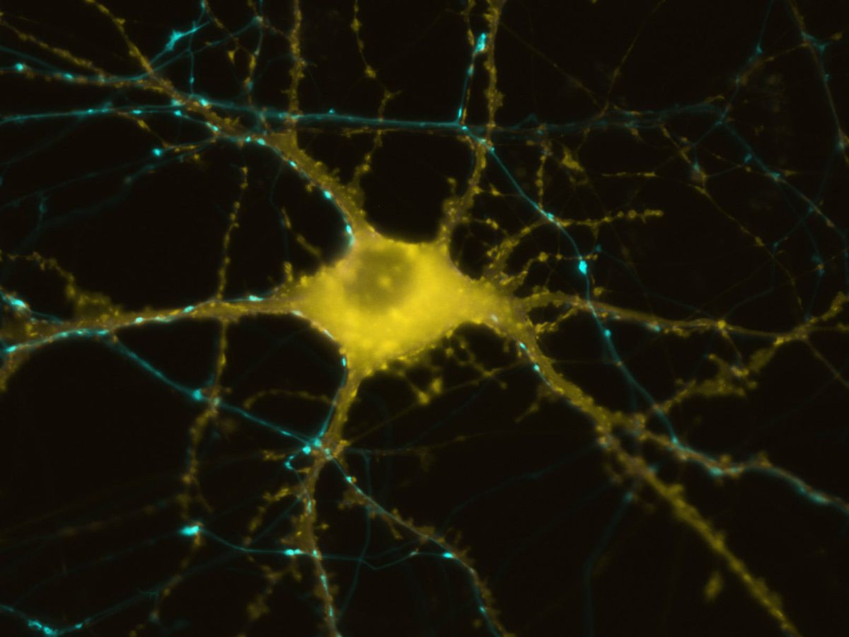 Foto: Una neurona del sistema nervioso