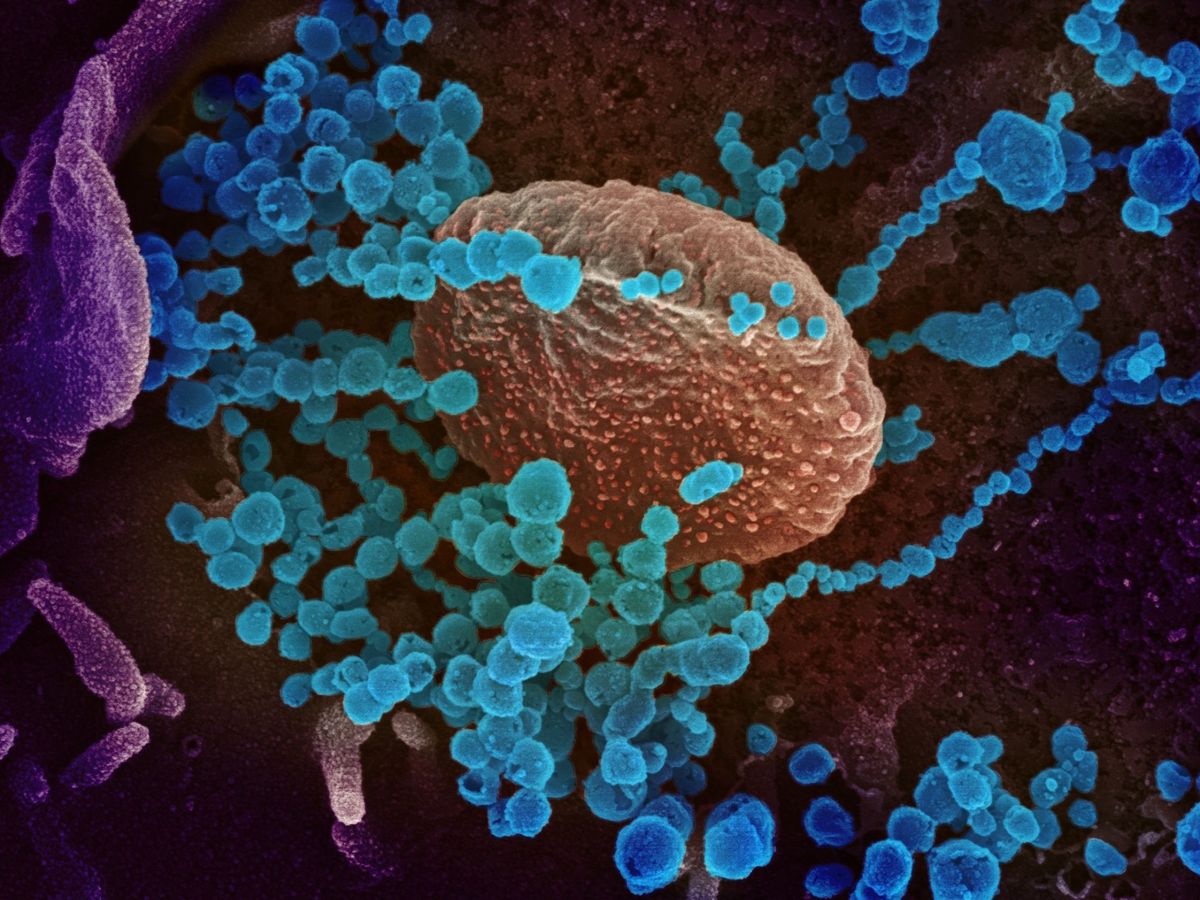 Foto: Imagen de microscopio que muestra en puntos azules el SARS-CoV-2. (EFE)