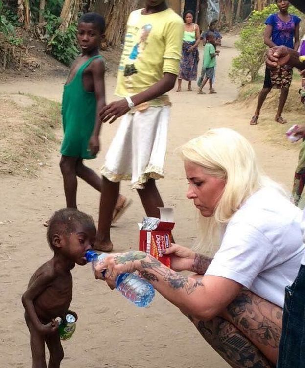 Foto: La imagen del 'niño brujo' a punto de morir de hambre que ha conmocionado al mundo (Facebook/Anja Ringgren Lovén)