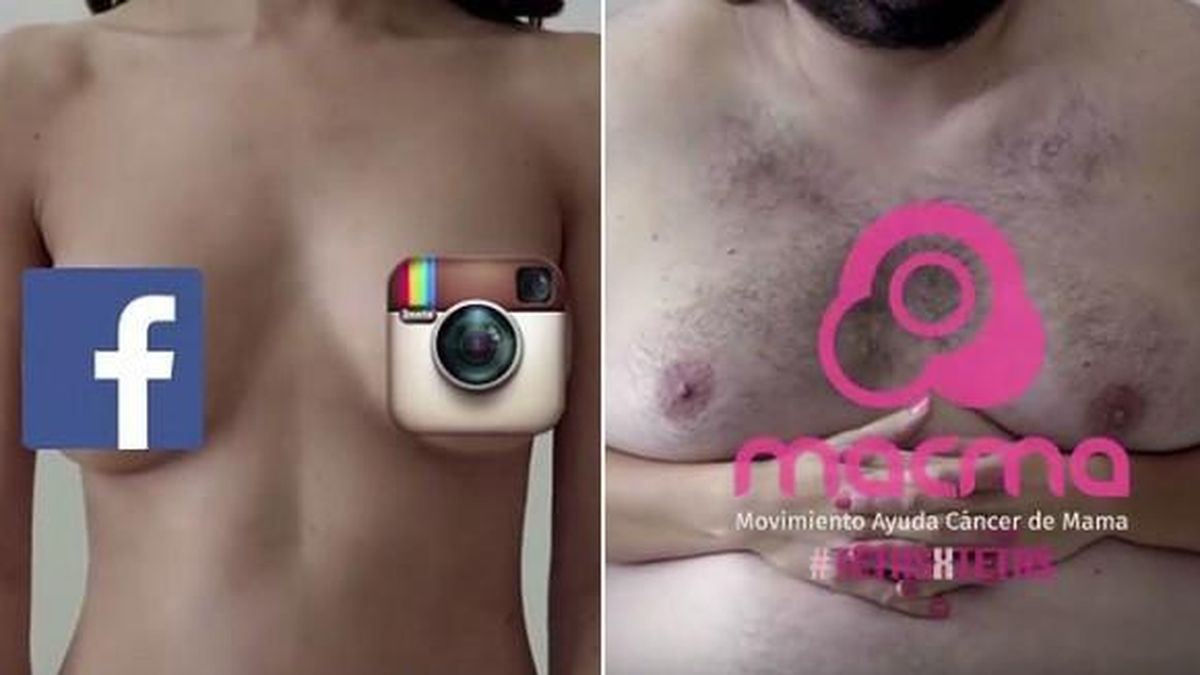 Pechos de hombres para hacer exámenes de mama por la censura de Facebook