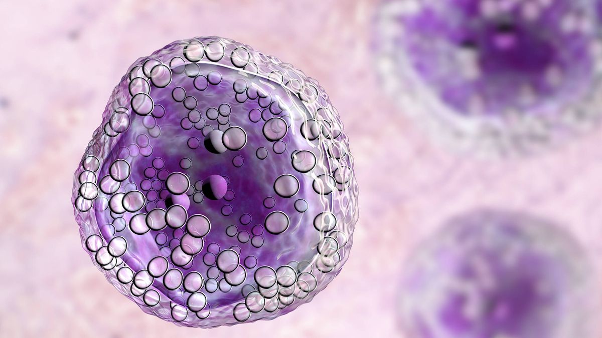 ¿Qué es un linfoma? Síntomas, tratamiento y otras claves de este cáncer