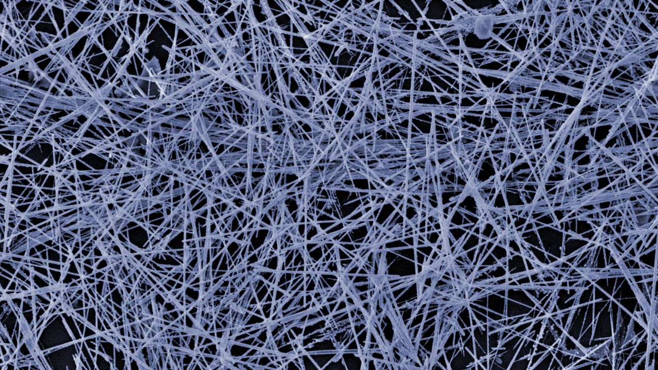 Foto: Imagen de microscopio electrónico de la red neuronal de nanohilos organizada de forma similar a una red neuronal real. (Universidad de Sydney)