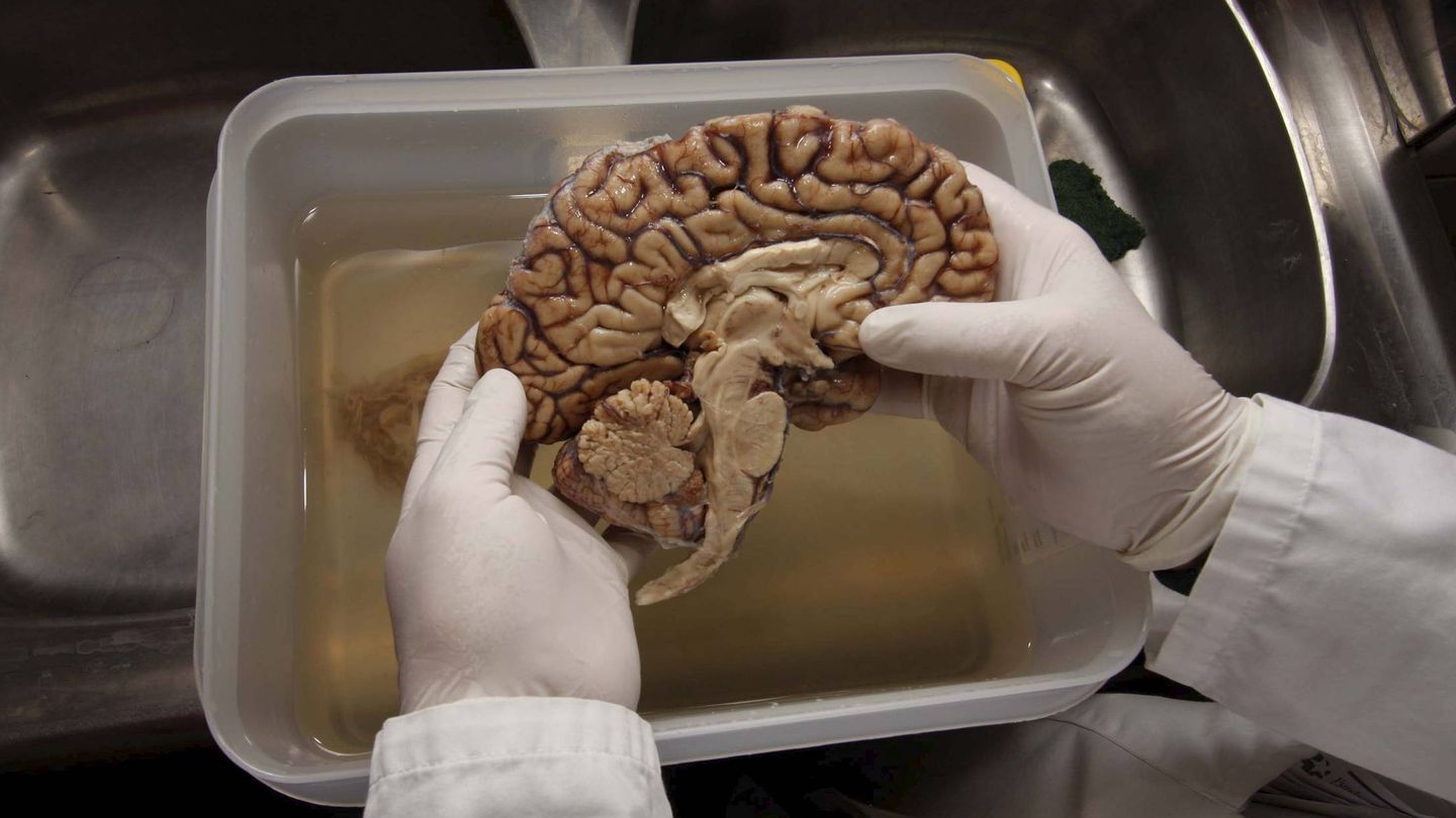 Cerebro en un banco de tejidos neurológicos. (EFE)