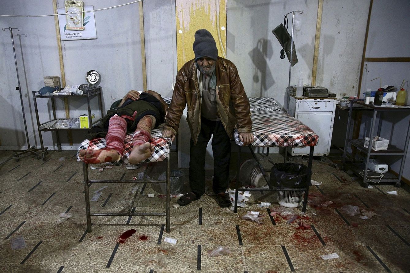 Un hombre herido en un bombardeo del régimen sirio en un hospital de Douma (Reuters).