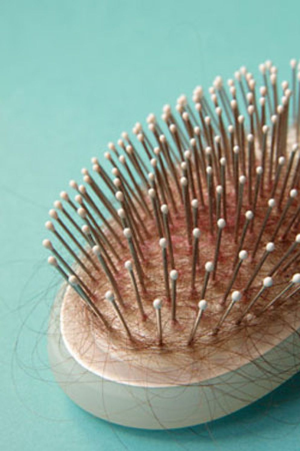 Foto: Casi ocho de cada diez españoles tienen tendencia a la alopecia