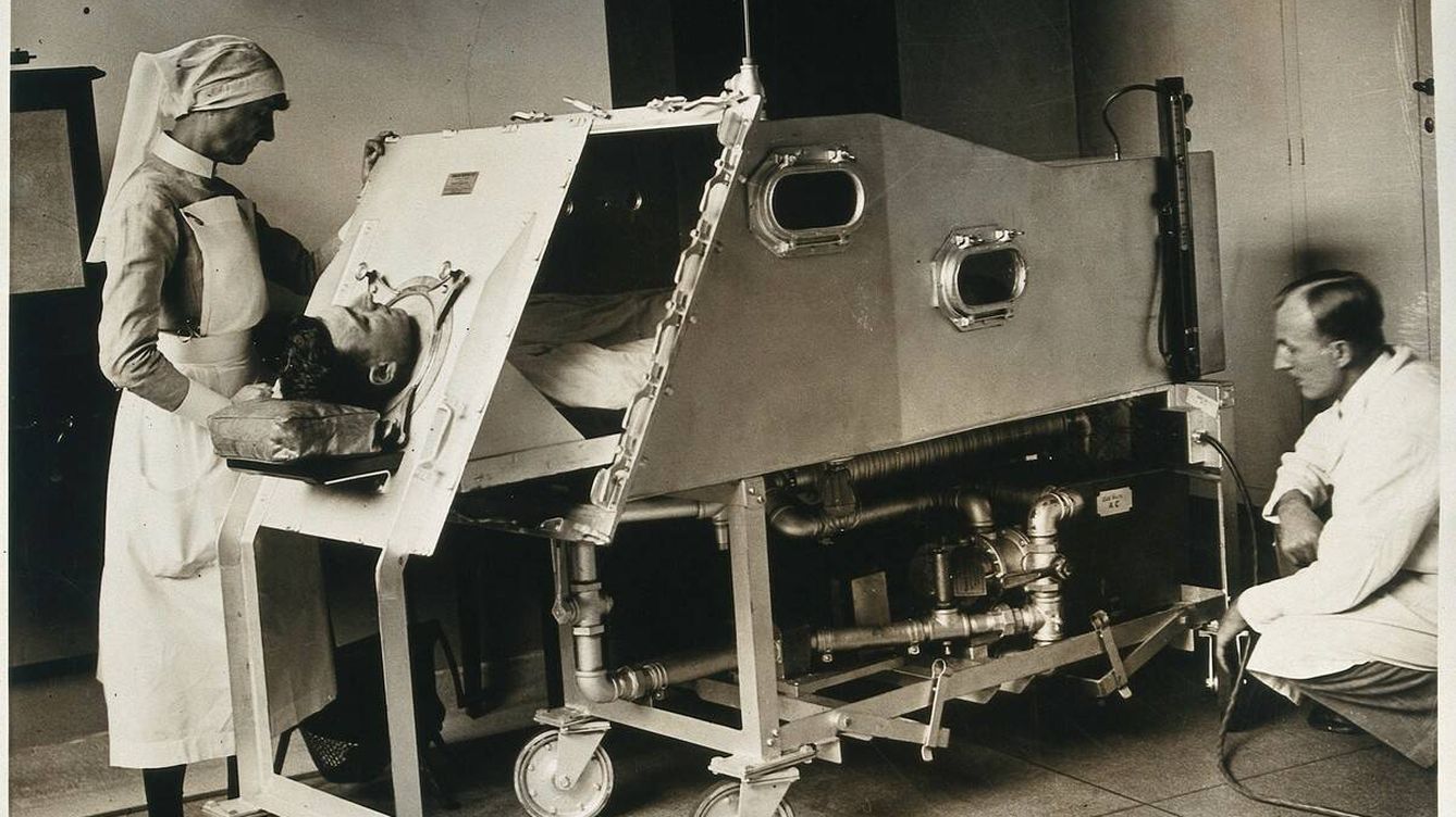 Foto: La polio se asoció a los temibles pulmones de acero. En la imagen, uno en el hospital St. Bartholomew de Londres, en 1930. (Wellcome Collection)