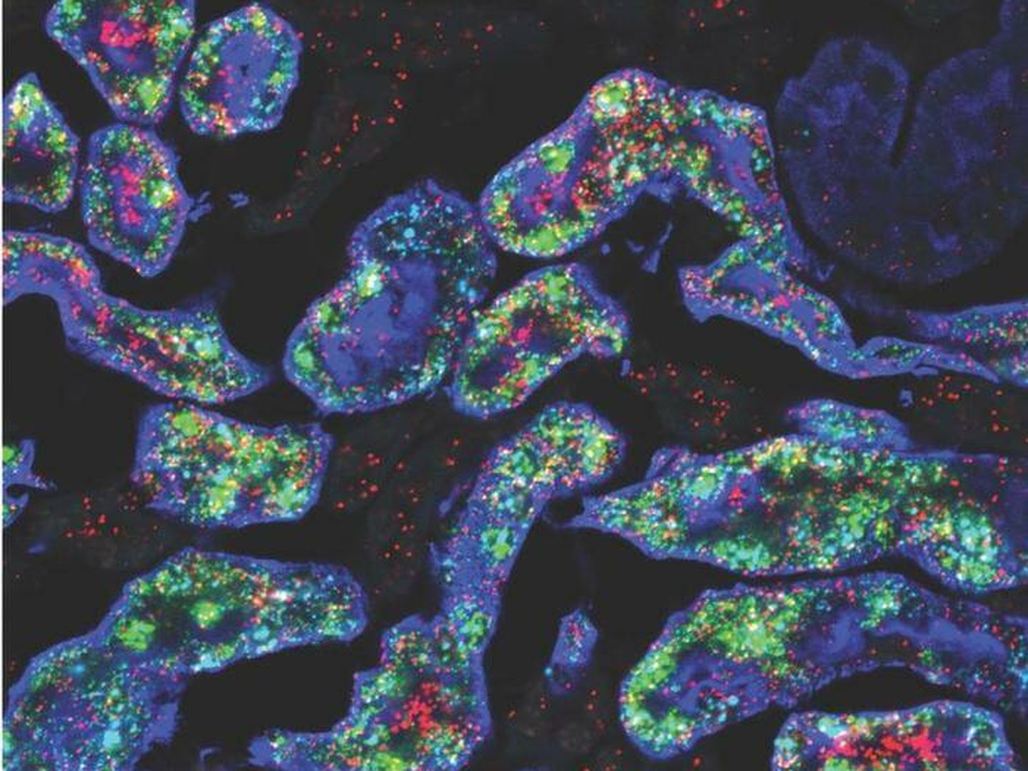 Las zonas verdes y rojas corresponden a genes que son más activos en los riñones femeninos (en azul). (Jing Liu/McMahon Lab)
