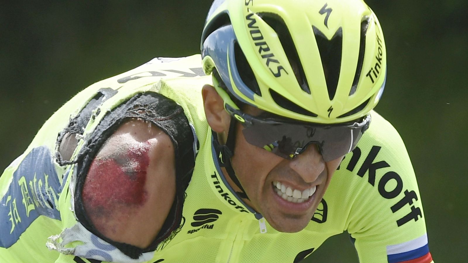 Foto: Uno de los hombros de Alberto Contador quedó seriamente dañado por la caída (Reuters)