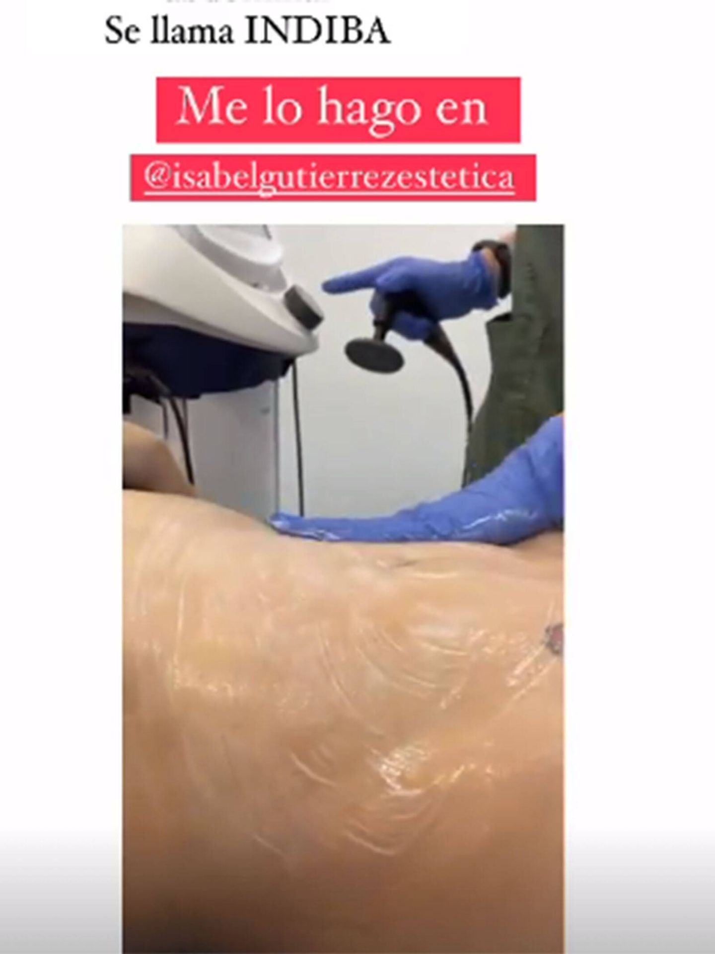Soraya Arnelas enseña su tratamiento en redes sociales. (Instagram @soraya82)