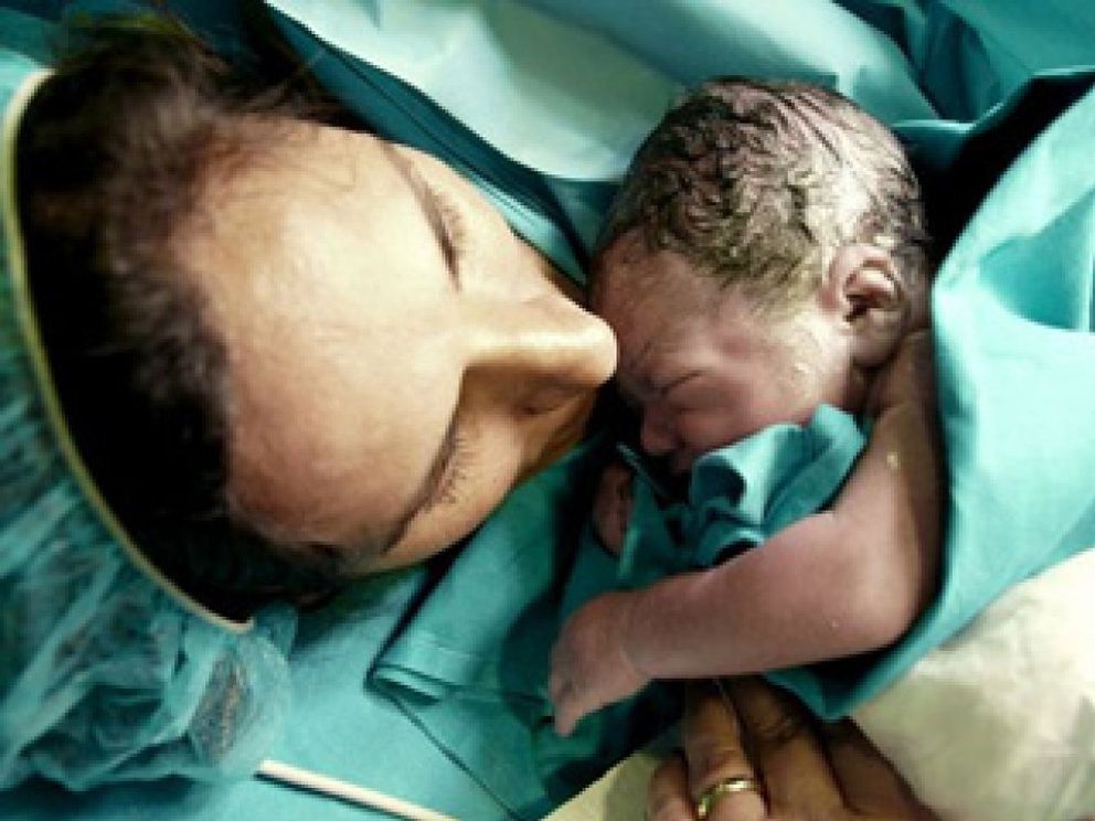 Foto: El primer bebé seleccionado genéticamente en España logra curar a su hermano enfermo