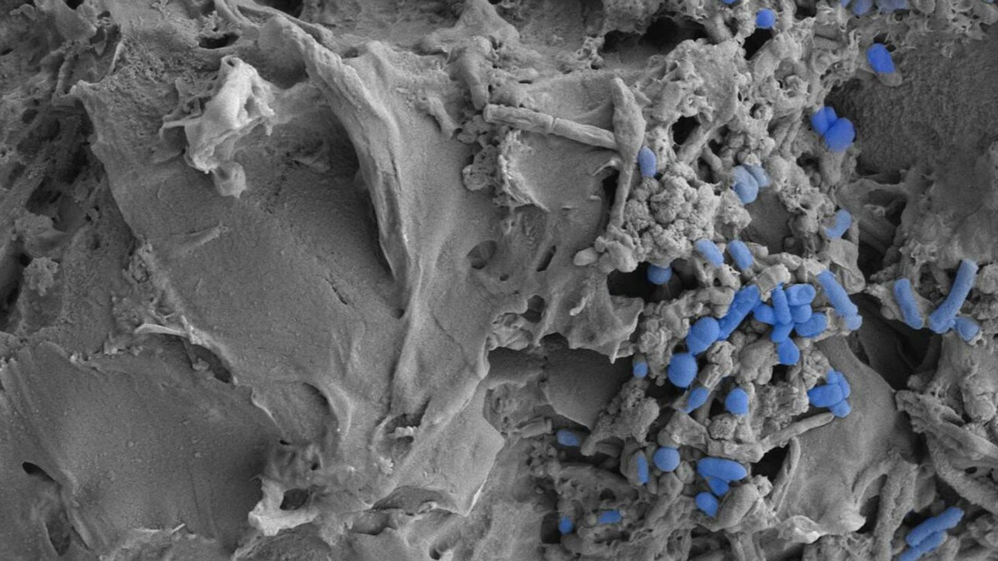 Microplásticos en la microbiota intestinal. (CSIC)