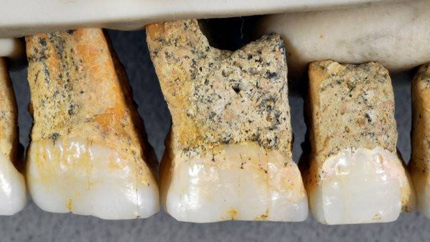 Los dientes hallados en la cueva.