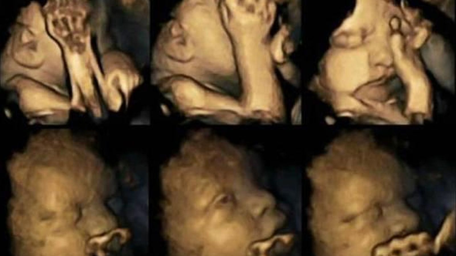 Foto: Los fetos de madres fumadoras se tocan más la cara