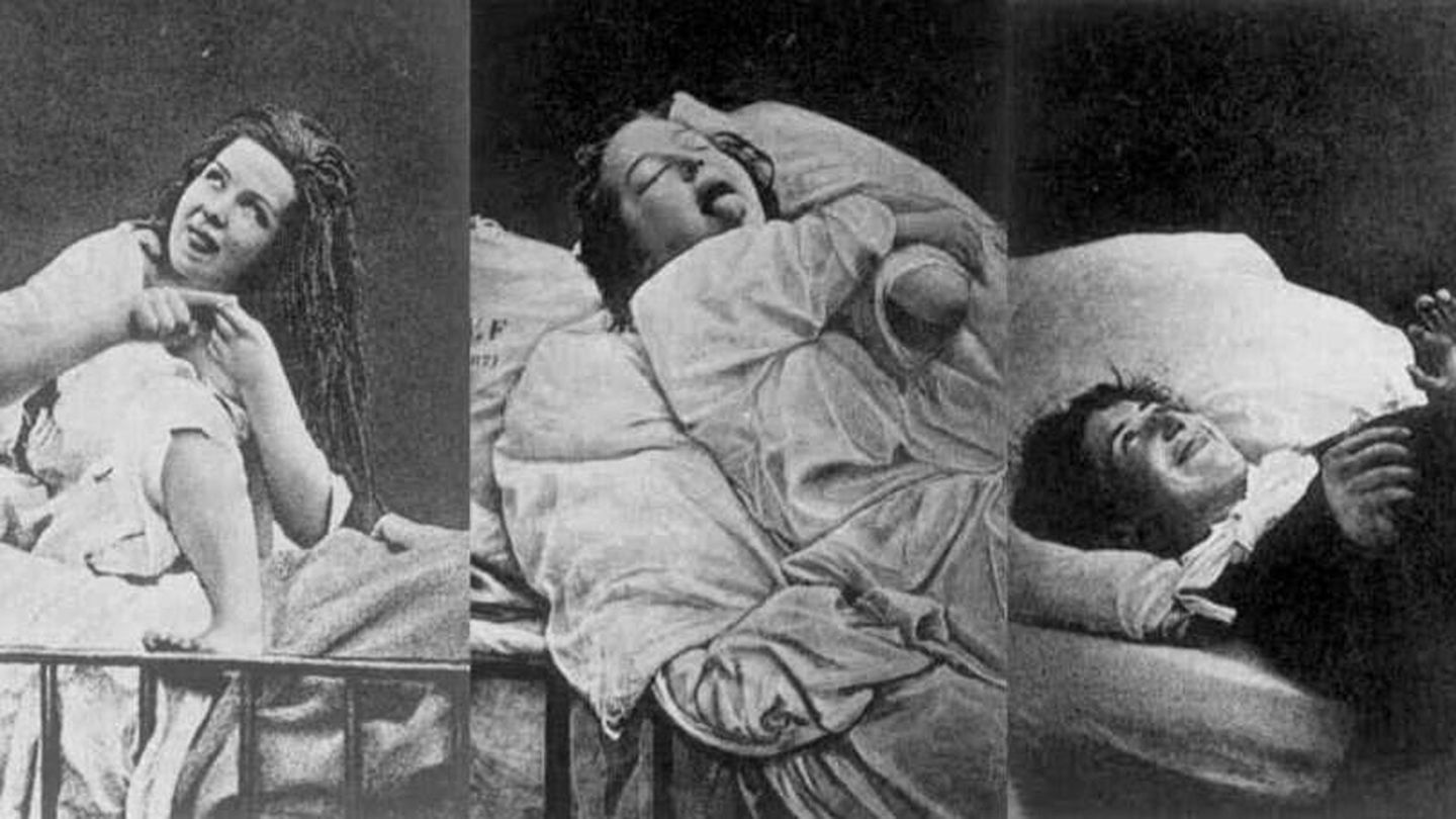 Secuencia de imágenes de otra paciente diagnosticada de histeria en la Salpêtrière. (Wikimedia)