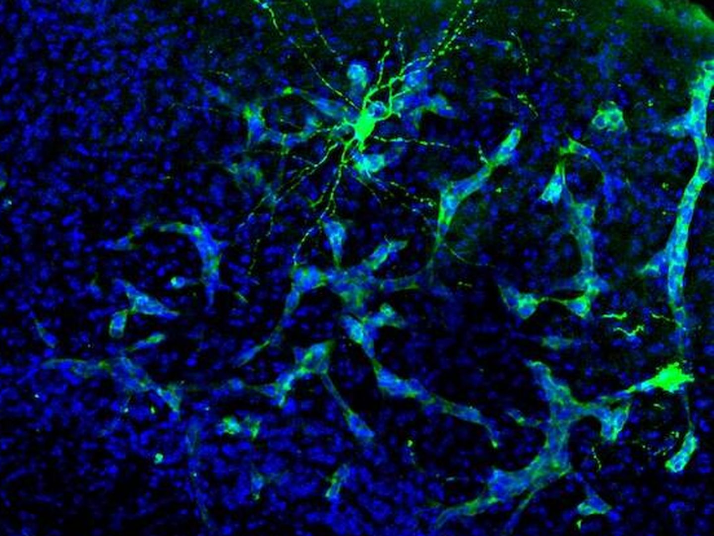 Metástasis de ratón (verde claro) interactuando con una neurona (verde oscuro). (Manuel Valiente)