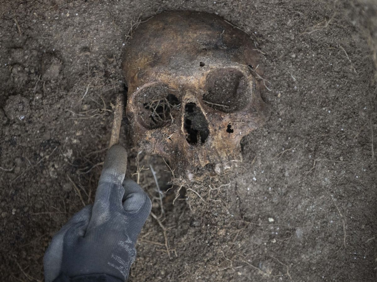 Foto: Imagen de archivo de un cráneo humano. (EFE/Brais Lorenzo)