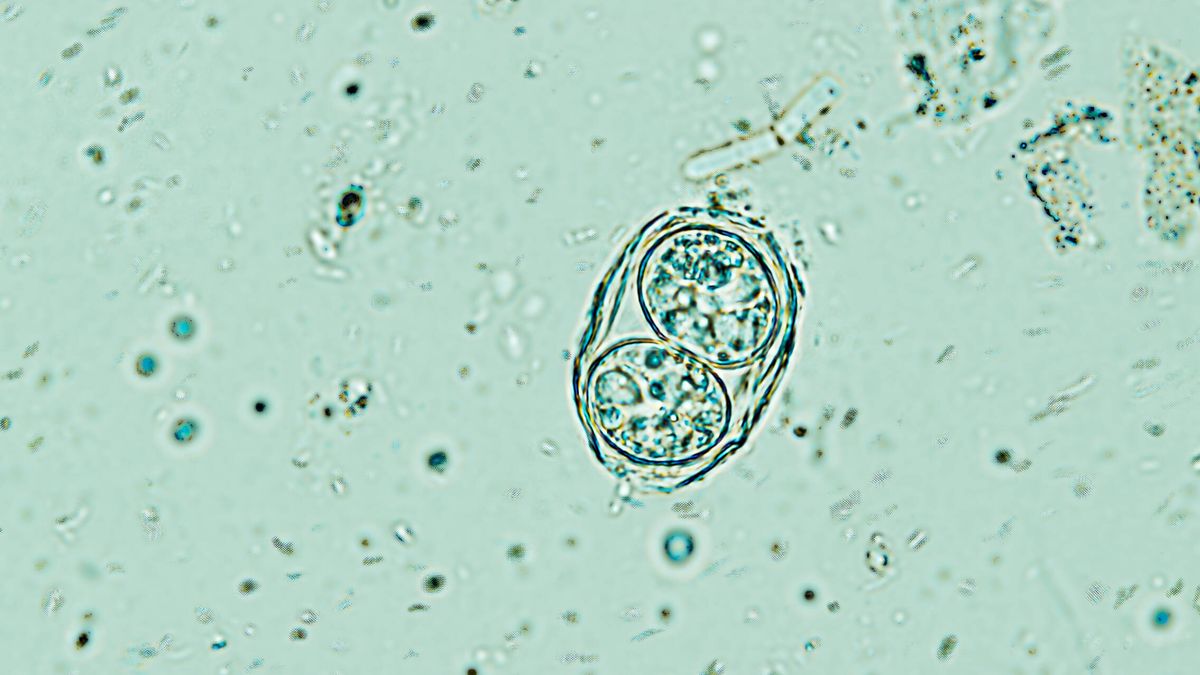 Toxoplasma gondii: así es el parásito más exitoso del mundo