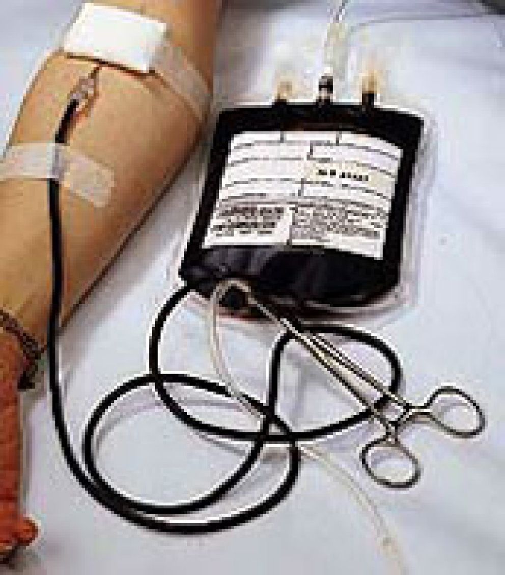 Foto: Donar sangre ayuda a mantener un buen estado de salud