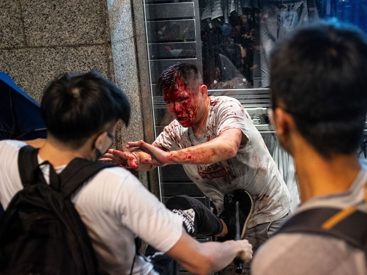 Foto: Un hombre ataca a cuatro personas con un cuchillo en Hong Kong. (Efe)