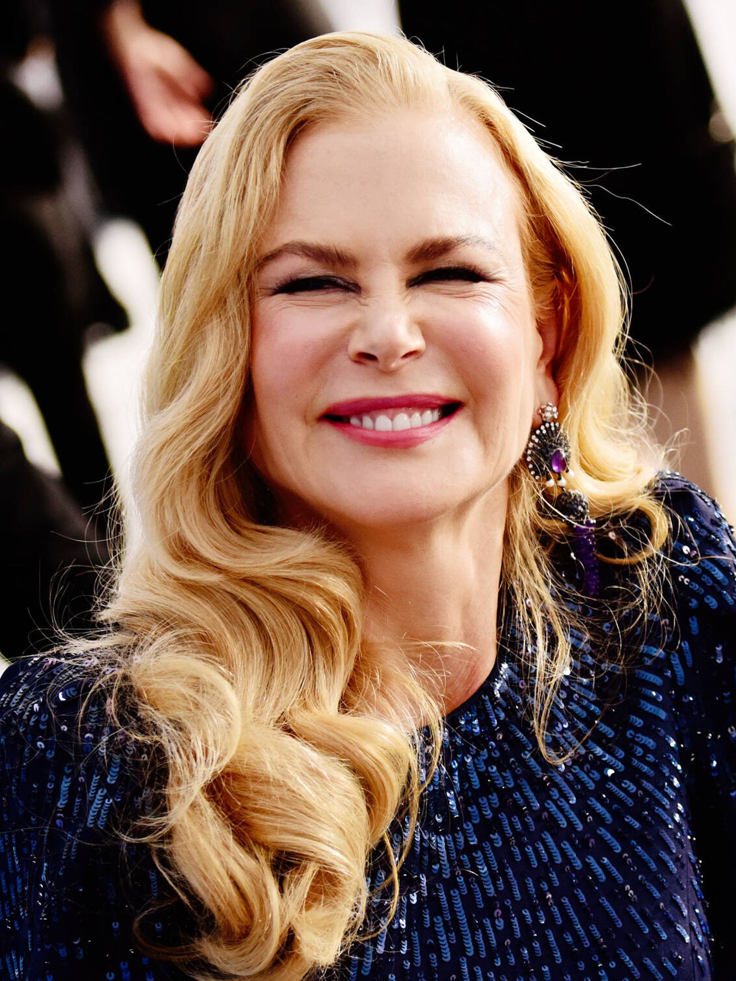 Las arrugas que se forman en alrededor de la nariz de Nicole Kidman son un ejemplo de bunny lines. (Getty/Chelsea Guglielmino)