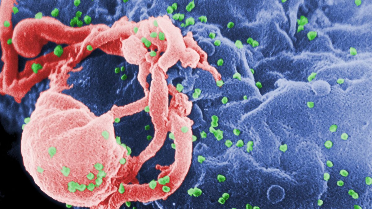 "También te puede tocar a ti": el sida aumenta mucho entre los treintañeros 