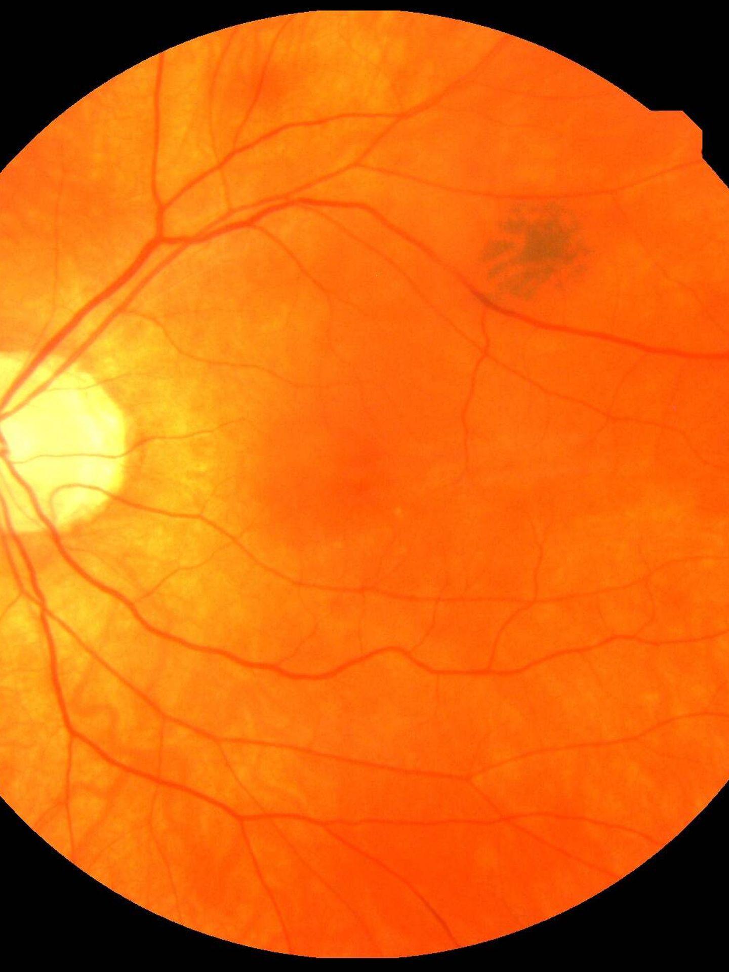 Escáner de retina. (Biobanco de Reino Unido)