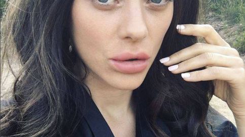 Los nuevos labios de Marion Cotillard… ¿qué se ha hecho?