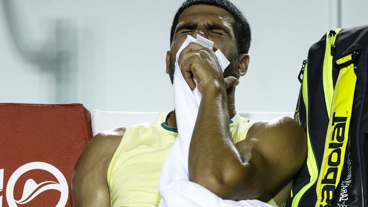 La impactante lesión de Carlos Alcaraz en Río: así se le quedó el tobillo tras doblarse por completo