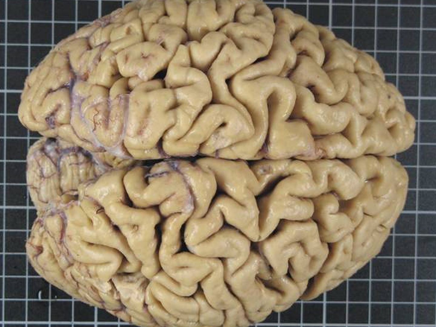 Un cerebro con los dos hemisferios antes de ser tallado.