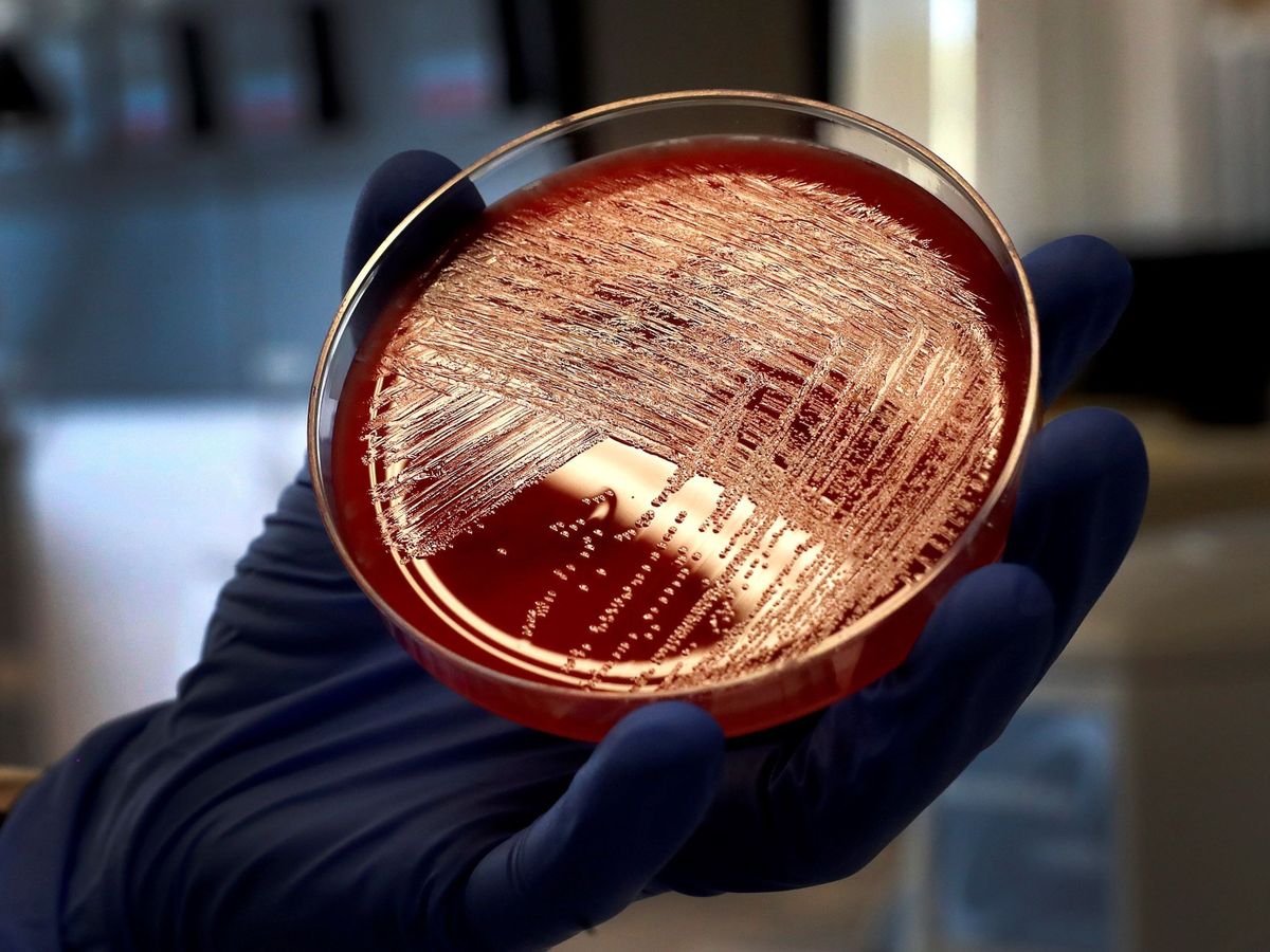 Foto: Vista de un cultivo de listeriosis en una placa de Petri. (EFE)