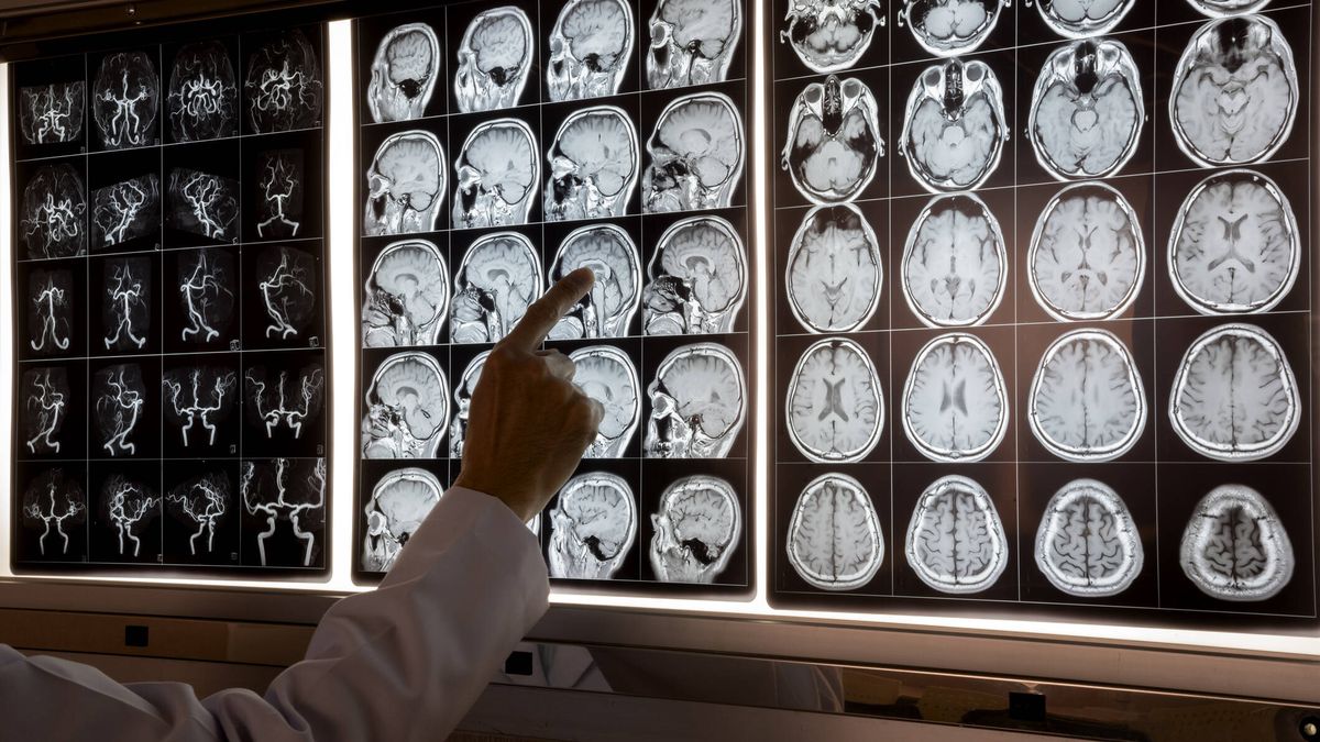 ¿Por qué hay casi 10.000 cerebros almacenados en Dinamarca? Un origen poco ético