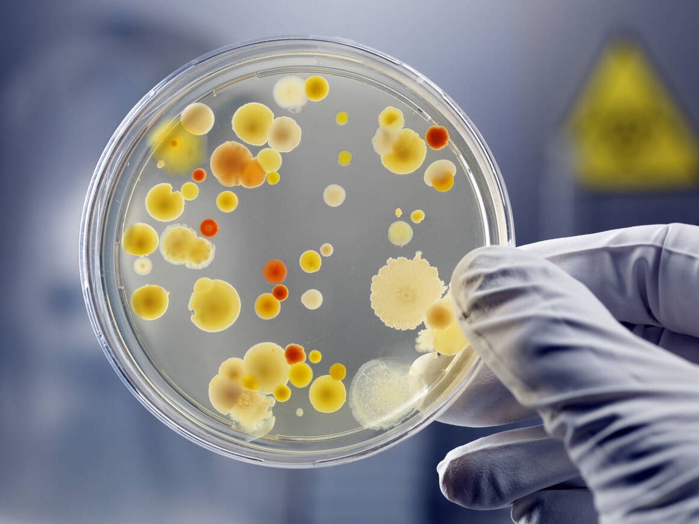 Cultivo de bacterias en una placa de Petri.  (iStock)