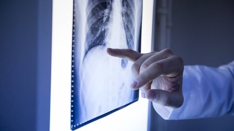 Aprendiendo a vivir mejor con el cáncer de pulmón 
