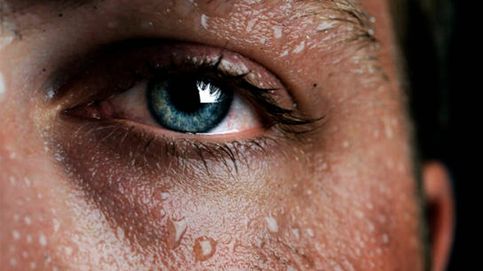 Alergia al sudor: por qué se produce, síntomas y tratamiento
