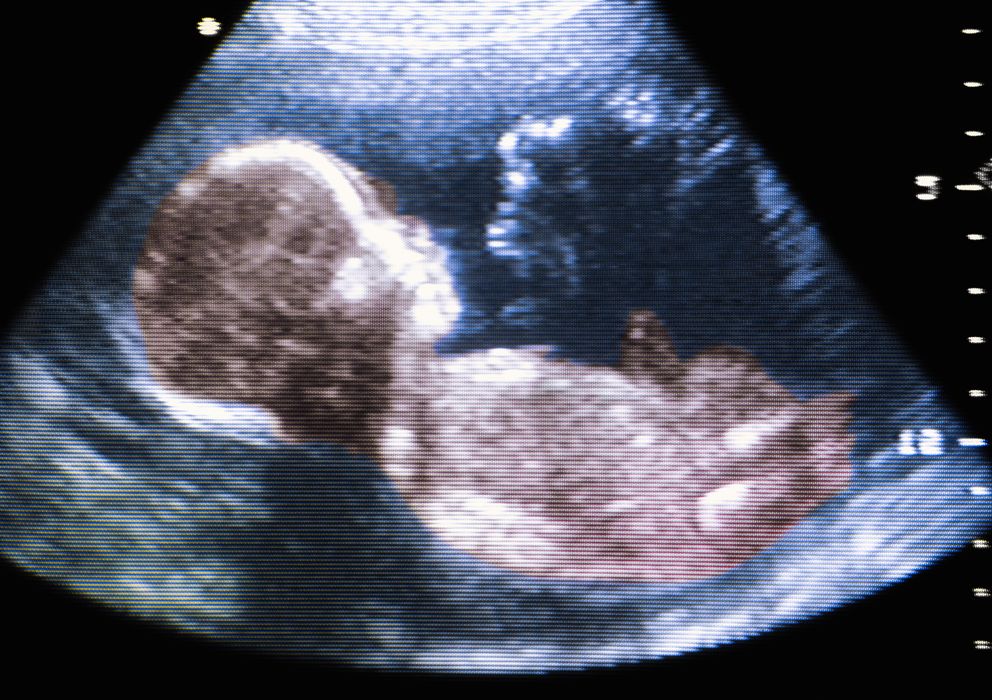 Foto: Un feto de 6 meses visto con ultrasonidos. (Corbis)
